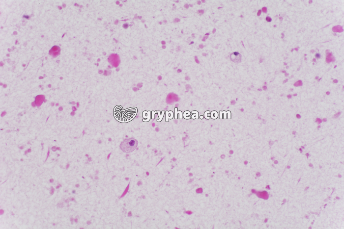 Prostate x100 - gryphea.com